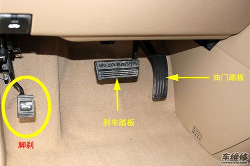 驻车制动类型哪种好
