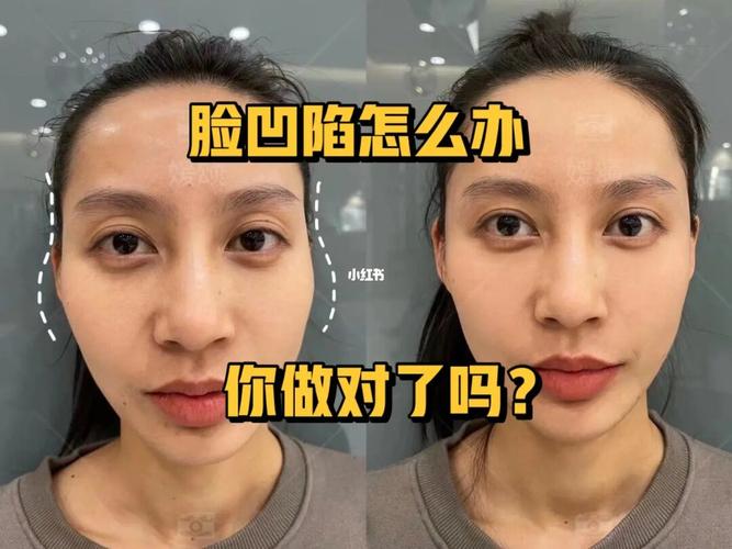 面部皮肤松弛如何改善