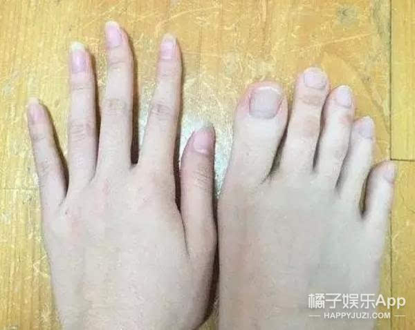 女人个子不高，但手指头和脚指头偏长是什么原因？