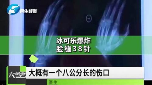 上海一男孩从冰箱拿冰冻可乐被炸伤缝了38针，冰可乐的杀伤力有多强？