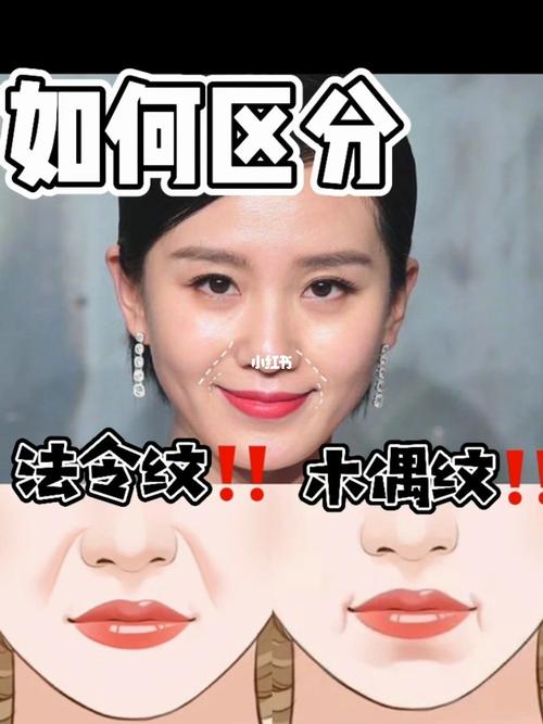 笑起来嘴角有两道纹叫什么纹