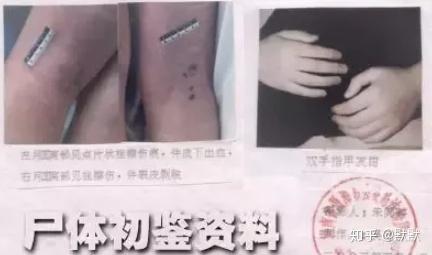 女教师裸死案回顾：尸检6次历经4年定案件，男友成最大嫌疑人，结果怎样？