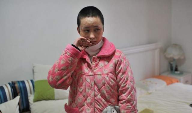 安徽16岁少女周岩，因拒官二代被泼汽油，10年过去，她过得怎样？