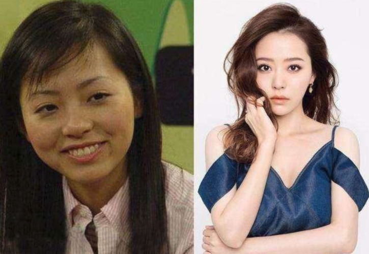 张靓颖整容了吗？？