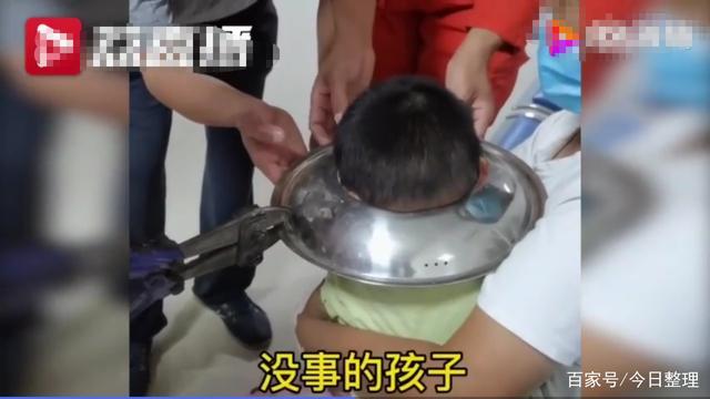 那个掉进锅里小男孩卢亮现在怎么样了？