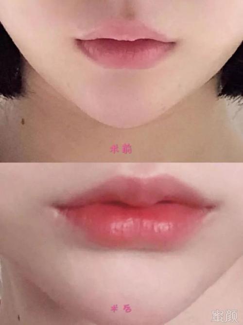 读唇术的读唇术的使用