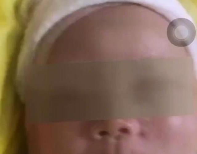 当年被父亲毒打的两个月大婴儿现状？