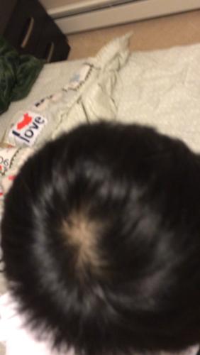 头顶头发特少 适合剪什么发型