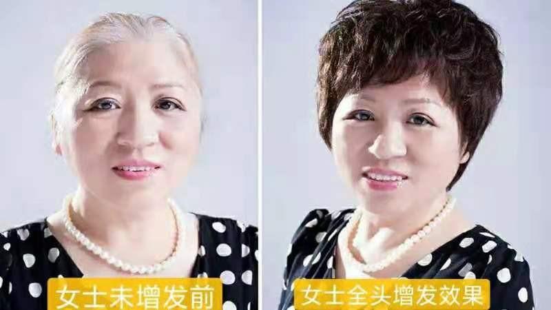 假发都有什么样的啊