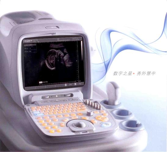 便携式b超机多少钱