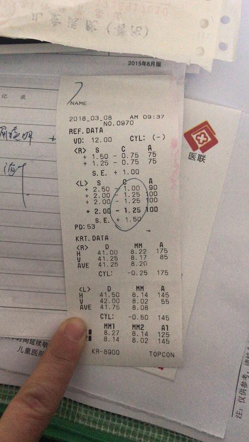 视力检测仪中的，s,c,a, ,-分别代表什么