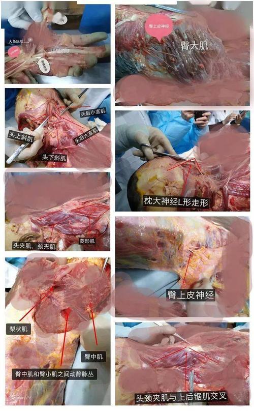 如何制作人体标本用来解剖？有图再加说明更好