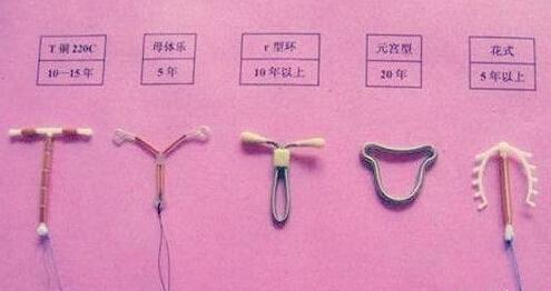 节育器是什么？