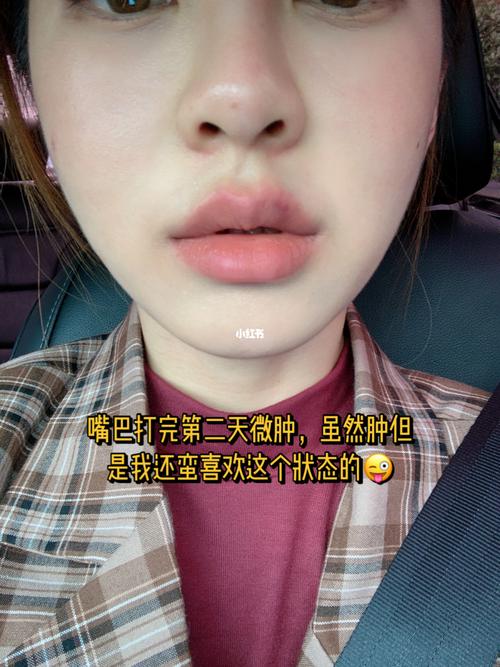 玻尿酸丰唇手术需要多少钱？真的是个手术吗？会不会疼啊？ ...