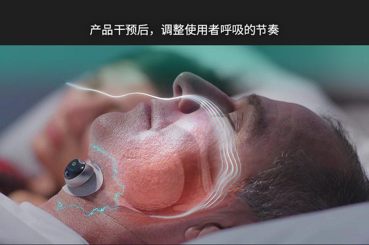 深圳云中飞止鼾仪怎么样