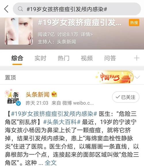 19岁女孩挤痘痘引发颅内感染，挤个痘痘这么危险吗？
