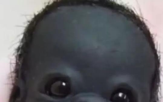 世界上最黑的孩子是什么样子的？