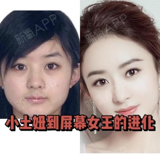 有人说赵丽颖整容了，这消息到底是不是真的？